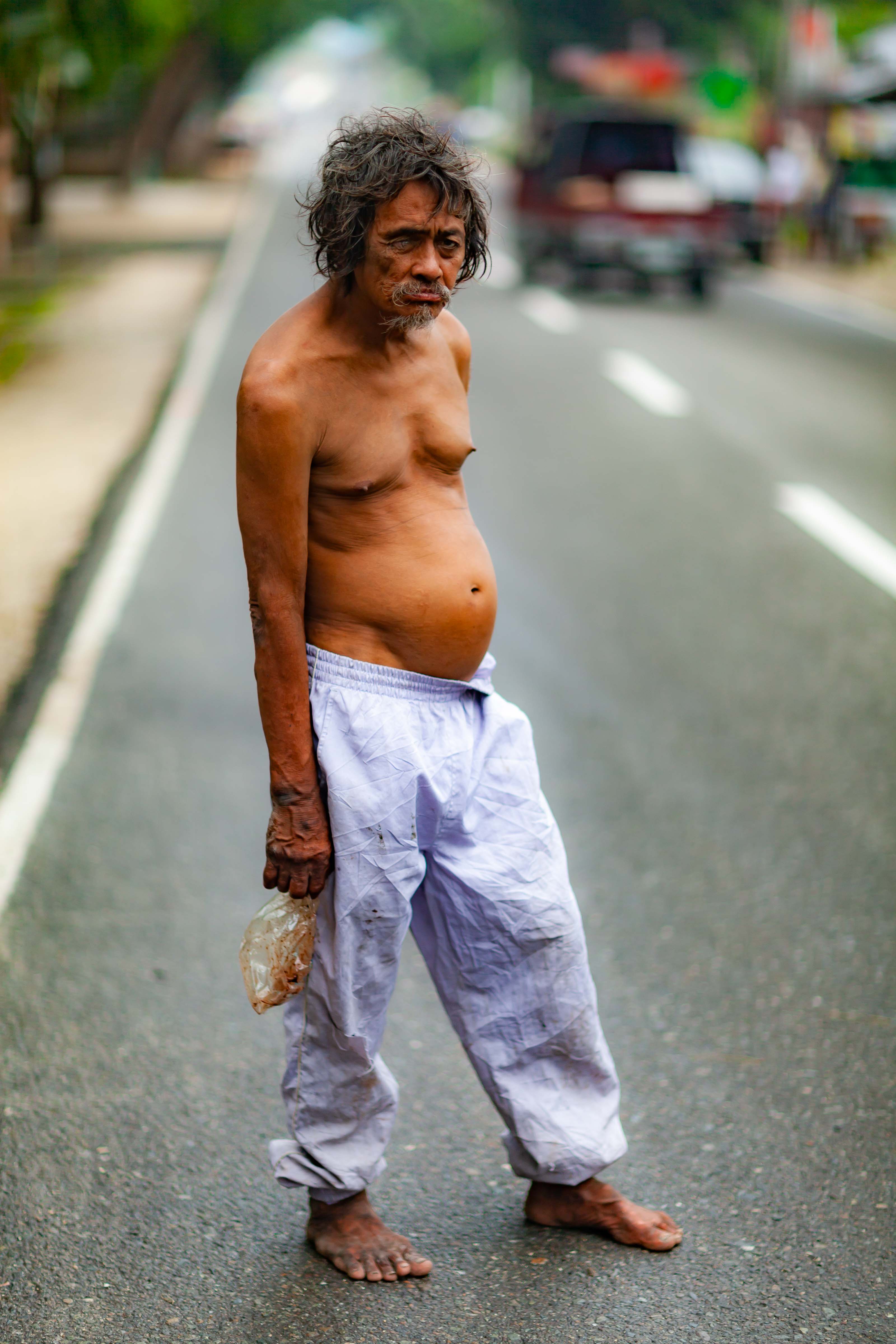 Philippines, Cebu Prov, Man With Vulture Eye, 2011, IMG 0427
