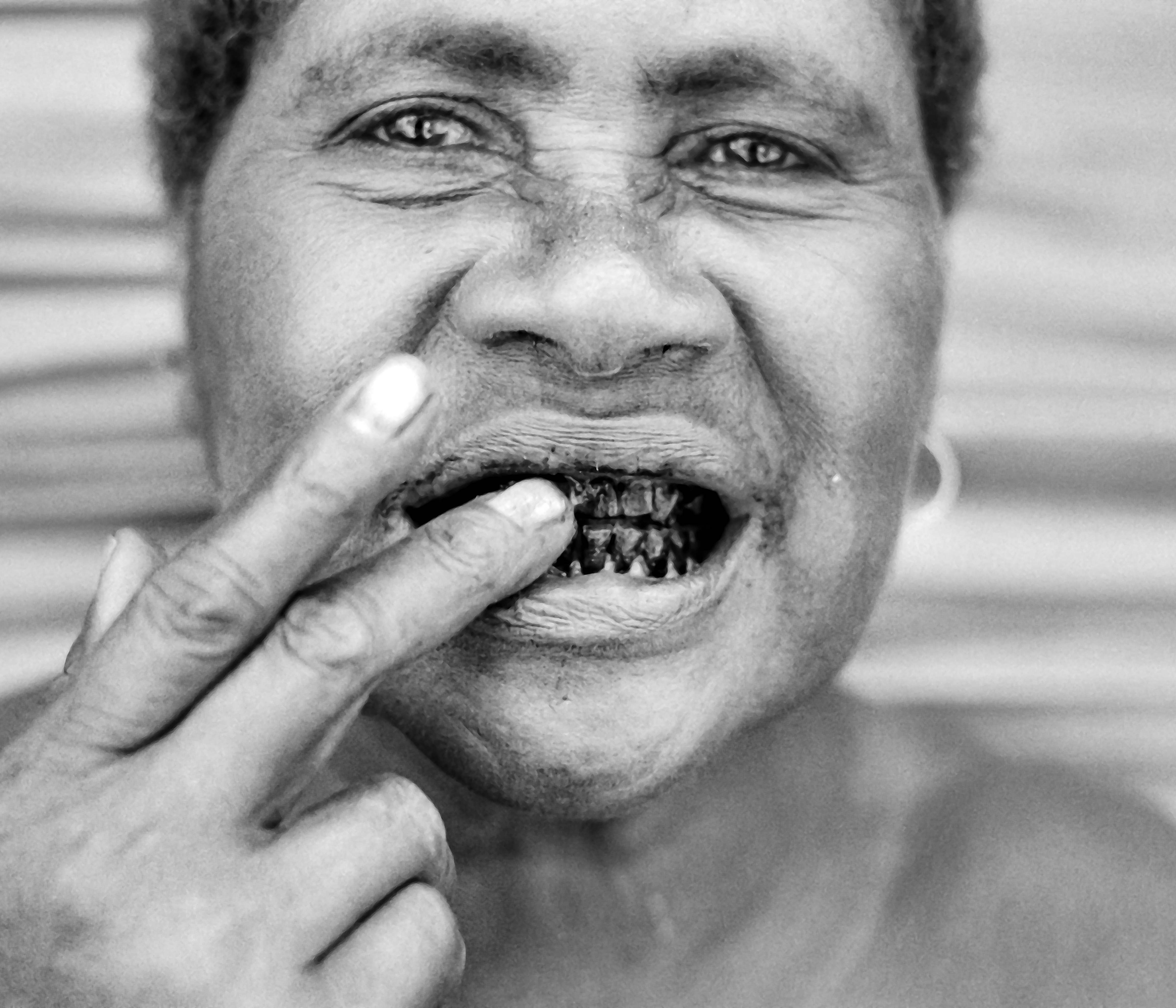 Solomon Islands, Malaita, Black Teeth, 1982